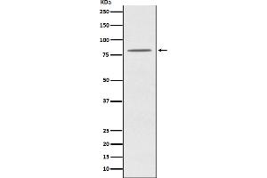 Western blot analysis of OPA1 expression in HeLa cell lysate.