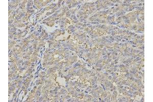 Immunohistochemistry (IHC) image for anti-Proteasome (Prosome, Macropain) 26S Subunit, Non-ATPase, 7 (PSMD7) antibody (ABIN1876544) (PSMD7 Antikörper)