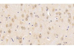 Detection of SNUPN1 in Mouse Cerebrum Tissue using Polyclonal Antibody to Snurportin 1 (SNUPN1)