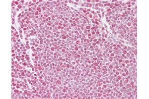 Immunohistochemistry (IHC) image for anti-TAR DNA Binding Protein (TARDBP) (AA 252-301) antibody (ABIN6748566)