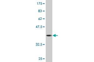 Western Blot detection against Immunogen (36. (CAMKK1 Antikörper  (AA 2-100))