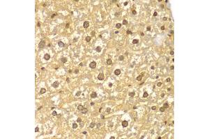 Immunohistochemistry of paraffin-embedded mouse liver using PYCARD antibody (ABIN5998640) at dilution of 1/100 (40x lens). (PYCARD Antikörper)