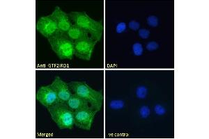 ABIN185681 Immunofluorescence analysis of paraformaldehyde fixed A431 cells, permeabilized with 0. (GTF2IRD1 Antikörper  (Internal Region))