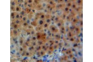 Used in DAB staining on fromalin fixed paraffin-embedded liver tissue (GLN1 Antikörper  (AA 1-373))