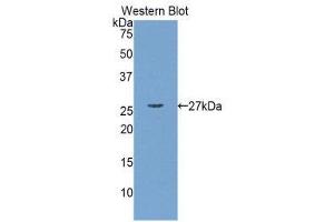 Western Blotting (WB) image for anti-Myosin Light Chain Kinase (MYLK) (AA 1684-1884) antibody (ABIN1859946)