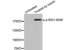 Western blot analysis of extracts from 3T3 cells, using Phospho-IRS1-S636 antibody. (IRS1 Antikörper  (pSer636))