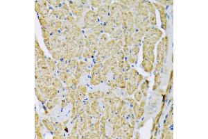 Immunohistochemistry (IHC) image for anti-Hexokinase 2 (HK2) (AA 1-120) antibody (ABIN3021256)