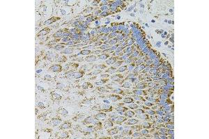 Immunohistochemistry of paraffin-embedded human esophagus using EPO antibody. (EPO Antikörper)