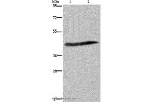 Western blot analysis of Human placenta tissue and HepG2 cell, using CSF2RA Polyclonal Antibody at dilution of 1:250