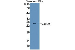 Detection of Recombinant SCCA1/SCCA2, Human using Polyclonal Antibody to Squamous Cell Carcinoma Antigen 1/2 (SCCA1/SCCA2) (Squamous Cell Carcinoma Antigen 1/2 (AA 211-390) Antikörper)