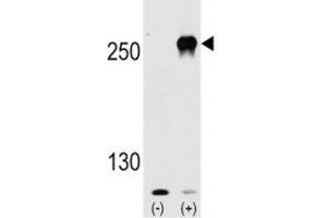 Western blot analysis of mTOR antibody and 293 cell lysate (2 ug/lane) either nontransfected (Lane 1) or transiently transfected with the mTOR gene (2). (MTOR Antikörper  (AA 2459-2488))