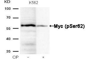 Western blot analysis of extracts from K562 cells, treated with calf intestinal phosphatase (CIP), using Myc (Phospho-Ser62) Antibody. (c-MYC Antikörper  (pSer62))