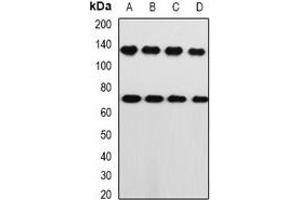 Western blot analysis of PRKG1 expression in A549 (A), PC3 (B), mouse lung (C), mouse heart (D) whole cell lysates. (PRKG1 Antikörper)
