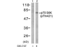 Image no. 2 for anti-Ribosomal Protein S6 Kinase, 70kDa, Polypeptide 1 (RPS6KB1) (pThr421) antibody (ABIN197014) (RPS6KB1 Antikörper  (pThr421))