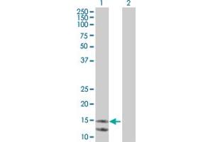Lane 1: MDK transfected lysate ( 15. (MDK 293T Cell Transient Overexpression Lysate(Denatured))