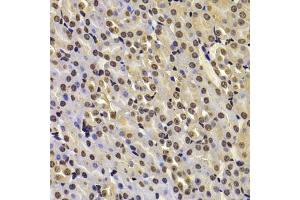 Immunohistochemistry of paraffin-embedded mouse kidney using FBXW7 antibody (ABIN6131632, ABIN6140535, ABIN6140537 and ABIN6221574) at dilution of 1:100 (40x lens). (FBXW7 Antikörper  (AA 408-707))