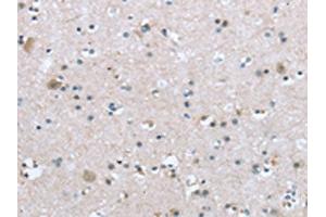 The image on the left is immunohistochemistry of paraffin-embedded Human brain tissue using ABIN7192921(TRPM3 Antibody) at dilution 1/20, on the right is treated with synthetic peptide. (TRPM3 Antikörper)