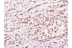 IHC-P Image Immunohistochemical analysis of paraffin-embedded A549 xenograft, using PRMT2, antibody at 1:100 dilution. (PRMT2 Antikörper)