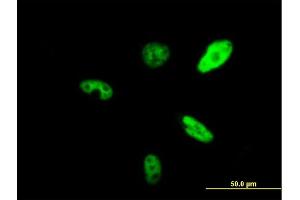 Immunofluorescence of purified MaxPab antibody to SMARCAD1 on HeLa cell.
