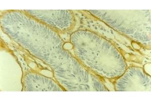 Image no. 1 for anti-Collagen, Type IV (COL4) antibody (ABIN335405) (Collagen IV Antikörper)