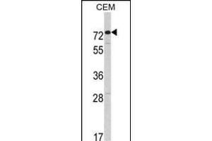Western blot analysis of HR2 Antibody (C-term) (ABIN391175 and ABIN2841275) in CEM cell line lysates (35 μg/lane). (AMHR2 Antikörper  (C-Term))