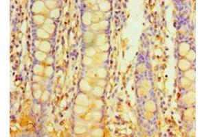 Immunohistochemistry of paraffin-embedded human colon tissue using ABIN7163238 at dilution of 1:100