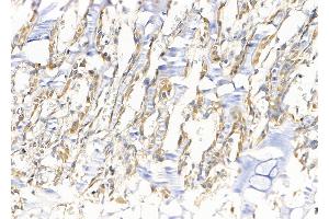 ABIN6265355 and ABIN6279867 at 1/100 staining Rat muscle tissue by IHC-P. (Syntaxin 6 Antikörper  (Internal Region))