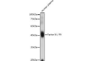 Western blot analysis of extracts of Human plasma, using Factor IX / F9 antibody (ABIN3022173, ABIN3022174, ABIN3022175, ABIN1512886 and ABIN6218646) at 1:1000 dilution.