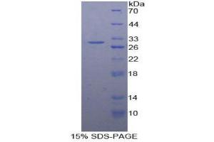 SDS-PAGE (SDS) image for Laminin, gamma 1 (LAMC1) (AA 521-772) protein (His tag) (ABIN2121525) (Laminin gamma 1 Protein (AA 521-772) (His tag))