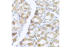 Immunohistochemistry of paraffin-embedded human stomach using PIK3CA antibody (ABIN6292231) at dilution of 1:100 (40x lens).