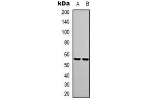 Western blot analysis of RUNX1 expression in Jurkat (A), THP1 (B) whole cell lysates. (RUNX1 Antikörper)