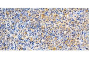 Immunohistochemistry of paraffin-embedded Rat spleen using PRKCE Polyclonal Antibody at dilution of 1:200 (40x lens). (PKC epsilon Antikörper)