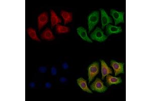 ABIN7094866 and ABIN7098918 staining Hela cells by IF/ICC. (SPRED2 Antikörper  (Internal Region))