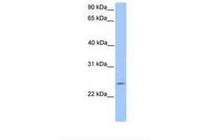 Image no. 1 for anti-Pituitary Tumor-Transforming 2 (PTTG2) (AA 51-100) antibody (ABIN6738720) (PTTG2 Antikörper  (AA 51-100))