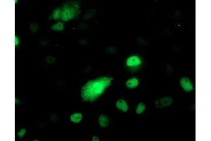 Anti-PHF21B mouse monoclonal antibody (ABIN2454829) immunofluorescent staining of COS7 cells transiently transfected by pCMV6-ENTRY PHF21B (RC204284). (PHF21B Antikörper)