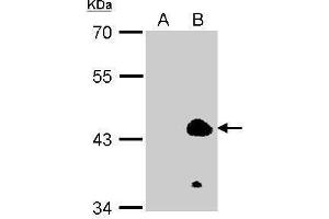 WB Image Sample (100ug of whole cell lysate) A: 293T (mock) B: 293T transfected KLF1 antibody diluted at 1:2000 (KLF1 Antikörper  (N-Term))
