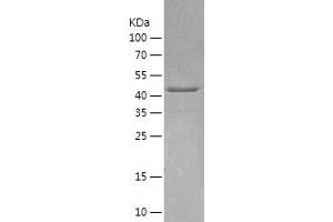 Western Blotting (WB) image for Arrestin, beta 1 (ARRB1) (AA 1-418) protein (His tag) (ABIN7121897)
