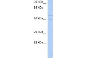 Western Blotting (WB) image for anti-serum/glucocorticoid Regulated Kinase Family, Member 3 (SGK3) (N-Term) antibody (ABIN2786285)