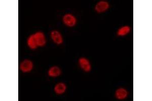ABIN6275687 staining Hela by IF/ICC. (ZC3H13 Antikörper  (C-Term))