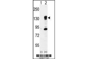 Western blot analysis of ITGA5 using rabbit polyclonal ITGA5 Antibody using 293 cell lysates (2 ug/lane) either nontransfected (Lane 1) or transiently transfected (Lane 2) with the ITGA5 gene. (ITGA5 Antikörper  (AA 575-602))