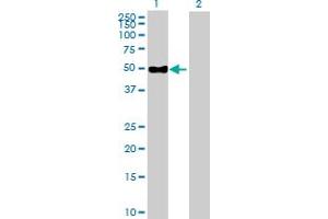 Western Blot analysis of ENPP6 expression in transfected 293T cell line by ENPP6 MaxPab polyclonal antibody. (ENPP6 Antikörper  (AA 1-440))