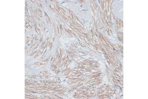 Immunohistochemistry of paraffin-embedded human uterus using Tropomyosin 1 antibody (ABIN3021577, ABIN3021578, ABIN3021579, ABIN1513635 and ABIN6215262) at dilution of 1:100 (40x lens). (Tropomyosin Antikörper  (AA 1-245))