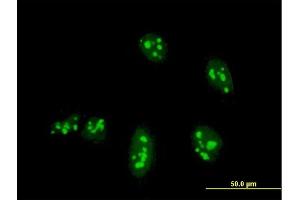 Immunofluorescence of monoclonal antibody to NANOG on HeLa cell. (Nanog Antikörper  (AA 98-195))