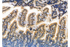 ABIN6261519 and ABIN6266943 at 1/100 staining Mouse colorectal tissue by IHC-P.