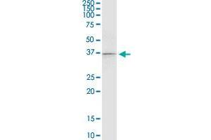 RASSF4 monoclonal antibody (M08), clone 1D5. (RASSF4 Antikörper  (AA 1-321))