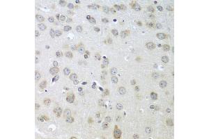 Immunohistochemistry of paraffin-embedded mouse brain using ACHE antibody (ABIN5974721) at dilution of 1/100 (40x lens). (Acetylcholinesterase Antikörper)