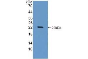 Western blot analysis of recombinant Horse SOD1. (SOD1 Antikörper  (AA 2-154))