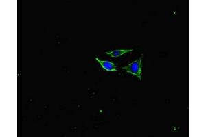 Immunofluorescent analysis of SH-SY5Y cells using ABIN7161278 at dilution of 1:100 and Alexa Fluor 488-congugated AffiniPure Goat Anti-Rabbit IgG(H+L) (NEFL Antikörper  (AA 128-271))