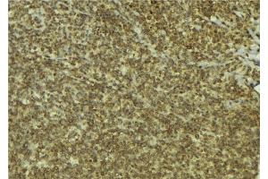 ABIN6279569 at 1/100 staining Mouse pancreas tissue by IHC-P. (ESCO1 Antikörper  (Internal Region))
