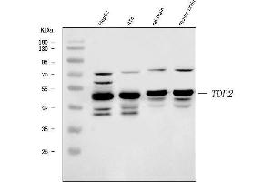Western blot analysis of TDP2 using anti-TDP2 antibody (ABIN7600905). (TDP2 Antikörper  (AA 25-332))